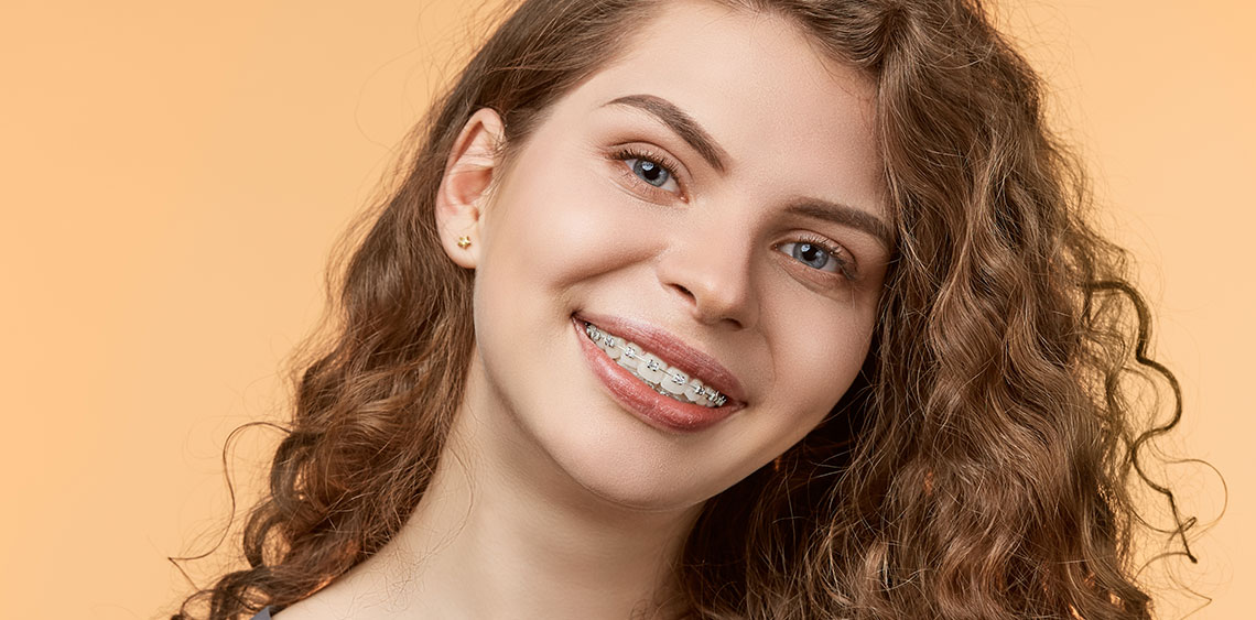 Porcelain Ceramic Braces Long Beach CA